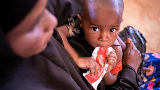 10 milhões de crianças desnutridas estão sem acesso a tratamento