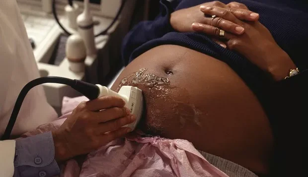 Estudo aponta que mulheres negras são mais vulneráveis ao aborto no Brasil